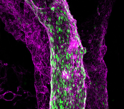 Cancer Biology